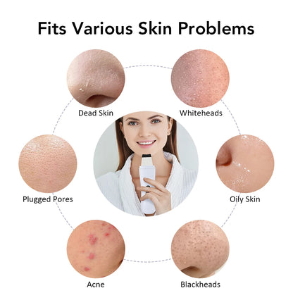 Ultrasonic Skin Scrubber - Varixo