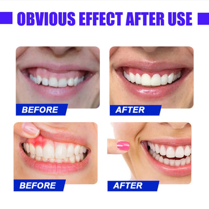 Red Light Therapy for Immediate Relief of Tooth Pain Gum Sensitivity
